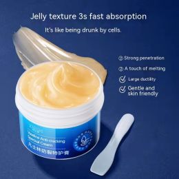 Moisturizing Body Lotion Hand And Foot Anti-freezing Cream (Option: 80g)