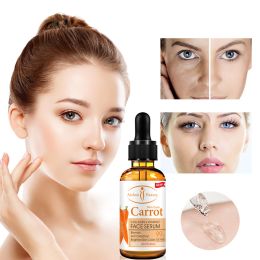 Cross Border Aichun Facial Replenishment Moisturizing Facial Moisturizing And Brightening The Of Firming (Option: Carrot)